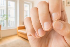 Ongles mous
