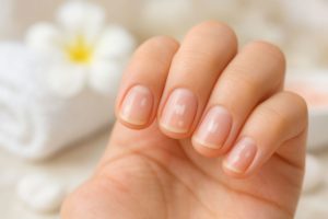 Tâches blanches sur les ongles